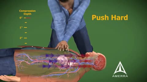 Cardiopulmonary Resuscitation (CPR) - 3D Medical Animation