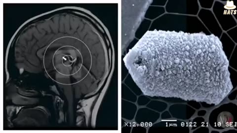 Pineal Gland Explained