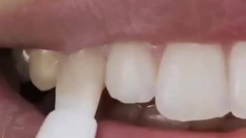 How Dentitox Unique Dental Works