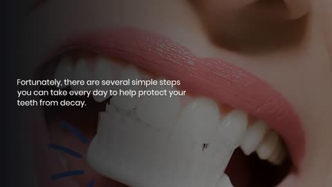 Tooth Decay Prevention: 10 Daily Dental Care Tips