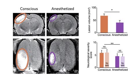 Ansethetic protects rat brains from damage after stroke