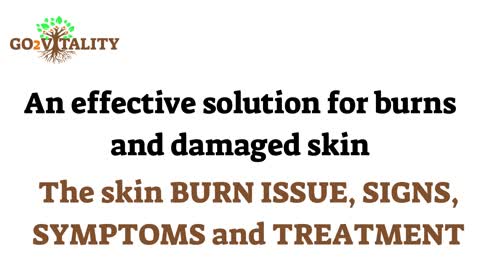 An effective solution for burns and damaged skin