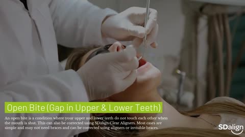 Ortho Dental Clinic | SD Align