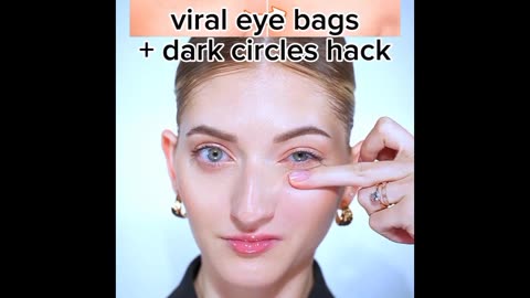 Viral eyebag