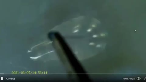 Morgellons in Masks and PCR-Test Swabs? 마스크와 코비드-19 테스트 면봉에 모겔론스가?