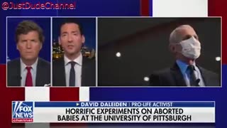 FreakShow Fauci - Experimented On Aborted Baby Heads - Beyond Fathom