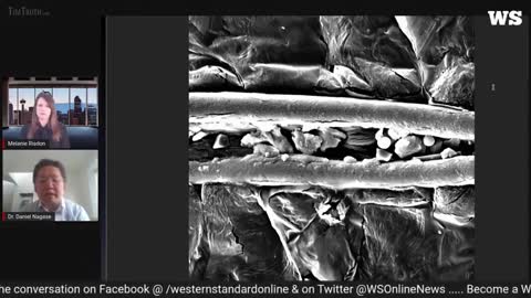 5G microchips found in the covid vaccine and their composition analysed under spectral analysis