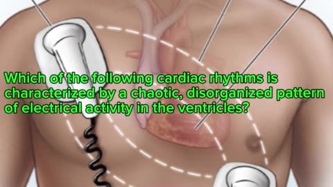 Defibrillator machine in icu #defibrillator #mcqs #pharmacologynotes #MedicalQuiz #mcqs #quiz