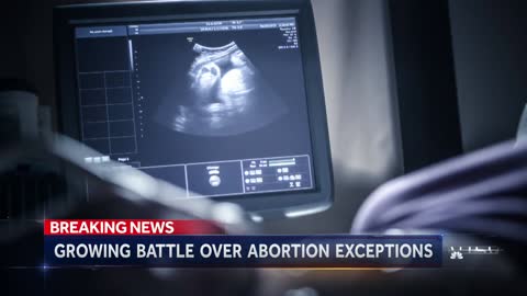 Few States With Abortion Restrictions Have Exceptions For Lethal Fetal Abnormalities