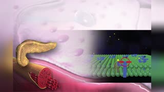 Insulin Resistance