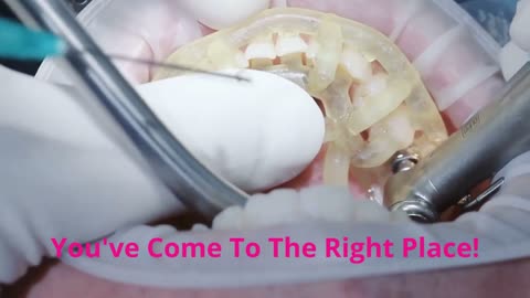 Periodontics And Implants in Rochester At DENTAL IMPLANTS & PERIODONTAL HEALTH