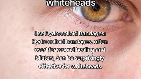 Say Goodbye to Whiteheads! Best Tips & Tricks for Clear Skin | 2023 Skincare Secrets #shorts