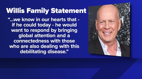 Dallas health experts discuss Bruce Willis' frontotemporal dementia diagnosis