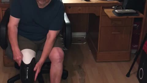 Amputee Prosthetic Leg Remove/Attach & Encouragement