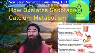 How Oxalates Sabotage Calcium Metabolism CREST, Kidney, & Gallbladder Stones