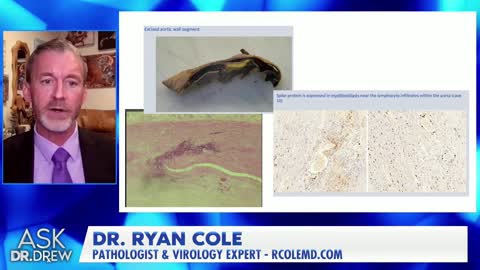 Das ist etwas Ungewöhnliches", erklärte Dr. Ryan Cole