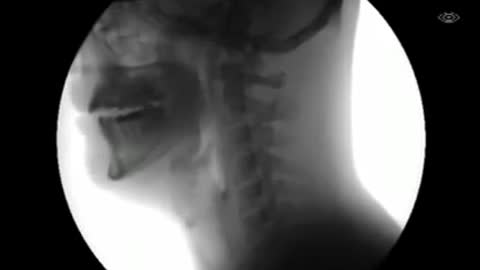 X-ray imaging of the pharynx area during swallowing Glory be to Allah
