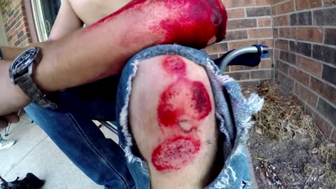 Ridiculous Wheelie Turned into Road Rash in a Flash