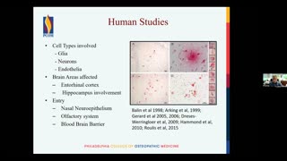 145. Chlamydia Pneumoniae Found in Alzheimer's Brains - Dr. Brian Balin