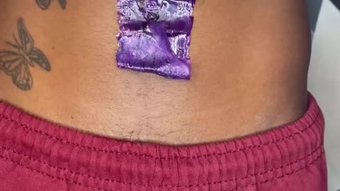 Stomach Waxing with Sexy Smooth Purple Seduction Hard Wax | TN Travel Esthetician