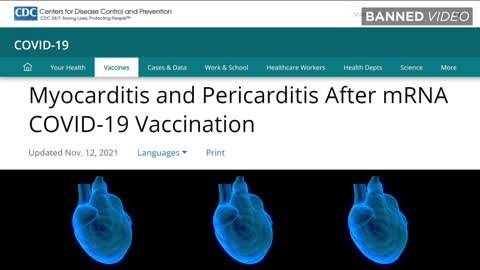 PROOF COVID-19 Vaccines Cause Cardiovascular Disease