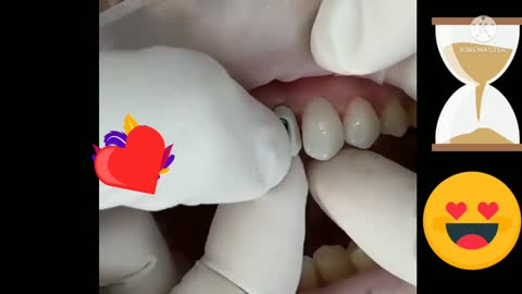 Teeth will health better .