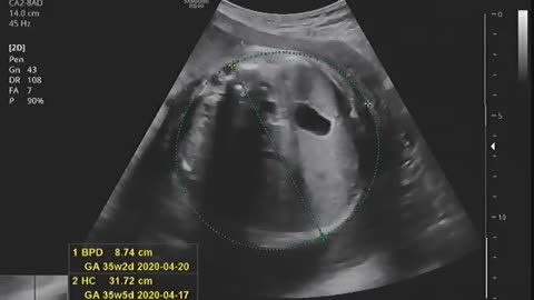 Baby ultrasound image and sound (7)