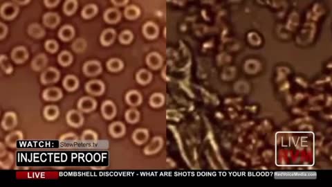 DR.JANE RUBY: PROOF !!! WHAT ARE SHOTS DOING TO YOUR BLOOD??? BOMBSHELL !!!