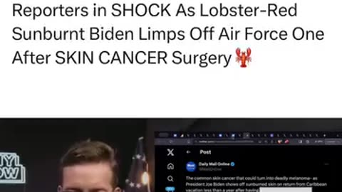 Reporters in SHOCK As Lobster-Red Sunburnt Biden Limps Off Air Force One After SKIN CANCER Surgery