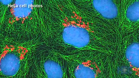 The immortal life of Henrietta Lacks