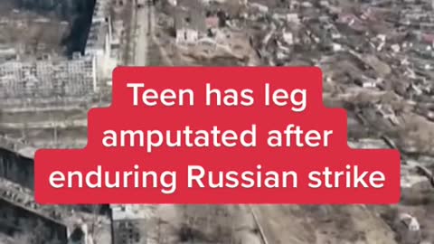 Teen has leg amputated after enduring Russian strike