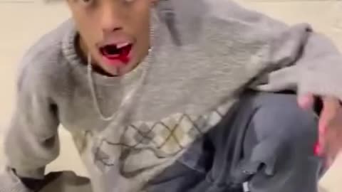 Skateboard man lost his teeth🙆‍♂️