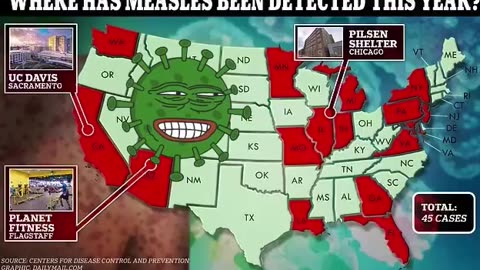 NEWS FLASH - "Major Measles Outbreak" Reported In 17 US States - 17 Coincidence?