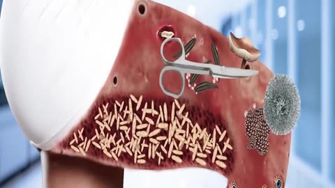 Most satisfying video remove dog ticks from infected ASMR Animation Video