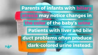 What Are The Symptoms Of Biliary Atresia?