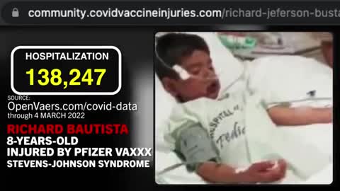 8-YEAR-OLD BOY SUFFERS HORRIFIC PFIZER VAXXX INDUCED INJURIES