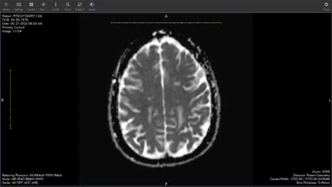 MRI with contrast