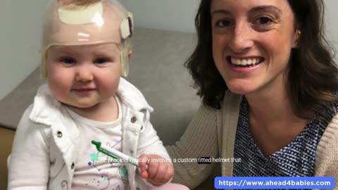 Infant With Flat Head Brachycephaly Treatment