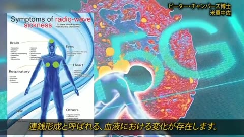 マールブルグ病はワクチンと5Gによって引き起こされる