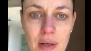 Insane Canadian Actress gets injured by Vax...would do it AGAIN!