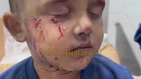 Little Palestinian Bombing Victim Fights His Tears