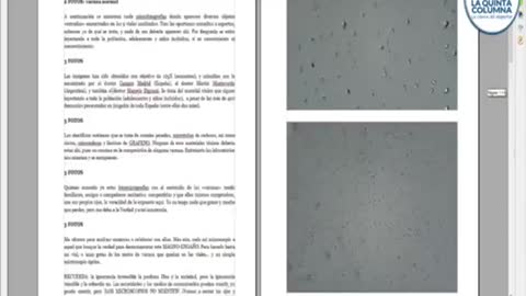 COVID VACCINE MICROPHOTOGRAPHS BY SALVADOR PEREZ MARTÍN