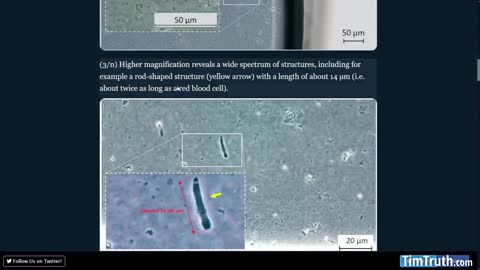 Analysis Of Moderna Vaccine Vial Shows Mystery Rod-like Objects & "Wide Spectrum of Structures"