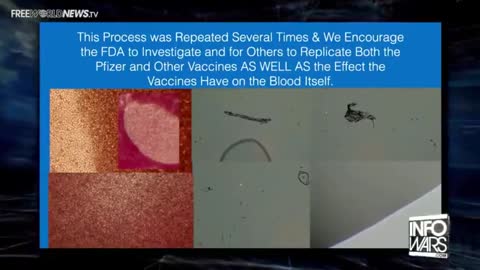 DISCOLORED & DEOXYGENATED: BLOOD CELLS EXPOSED TO PFIZER'S VACCINE LOSE HEALTHY RED COLOR & OXYGEN?!