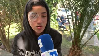 Pérdidas oculares en la represión de jóvenes manifestantes conmueve en Chile