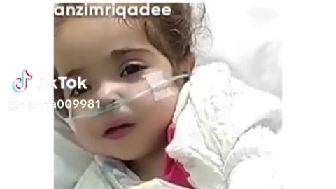 Palestini's Small Baby damage and in Israel attack