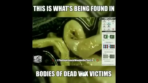THIS IS WHAT IS BEING FOUND IN THE BODIES OF DEAD VAXX VICTIMS