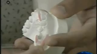 Regrowing Teeth using Frequency - AWESOME!