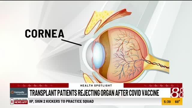 COVID-19 Vaccines | Transplant Patients Rejecting Organs After Receiving COVID-19 Vaccine