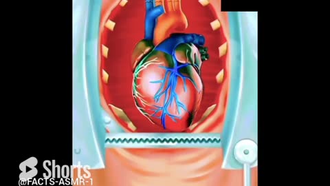 Heart bypass